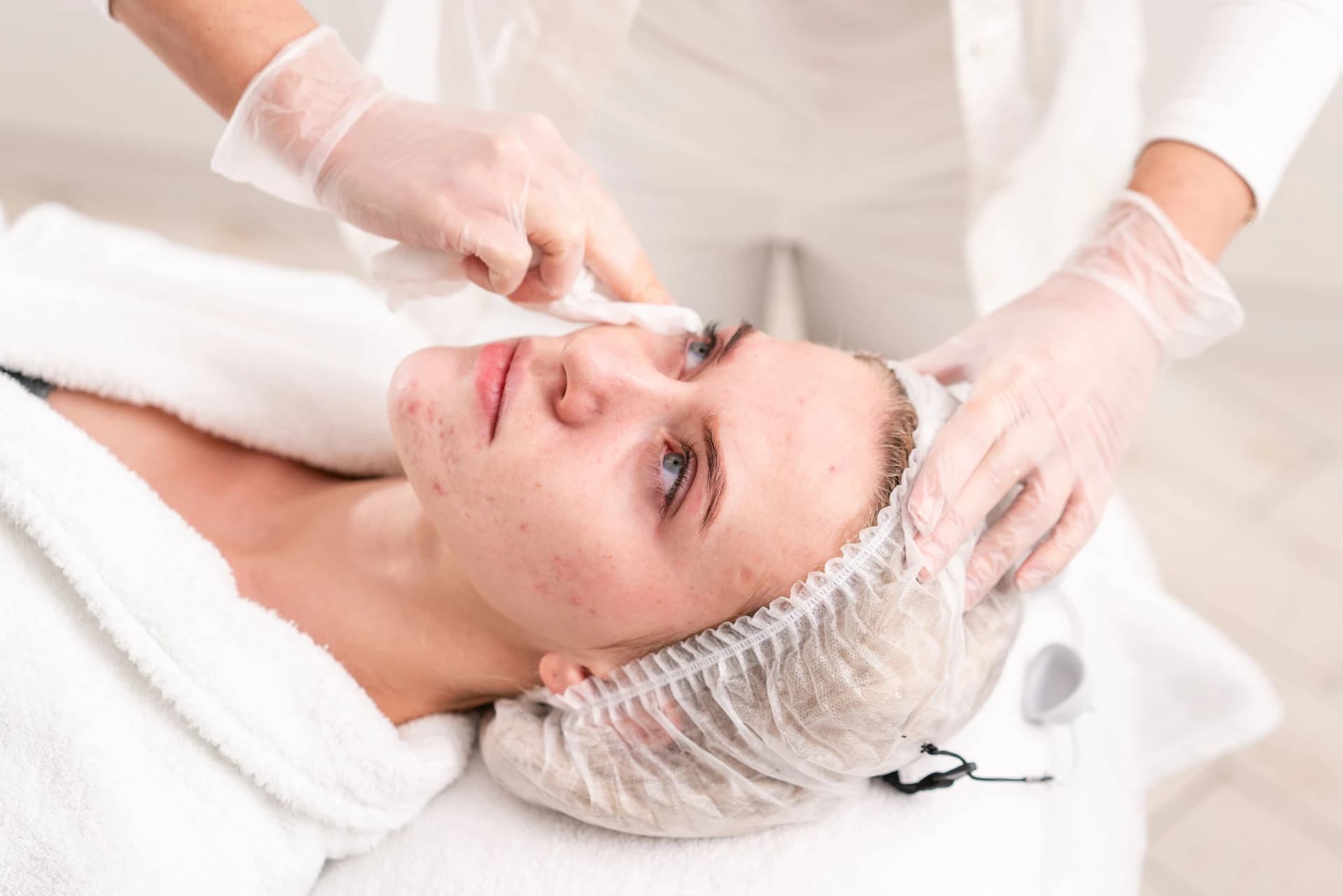 Luxe Clarifying Acne-Facial